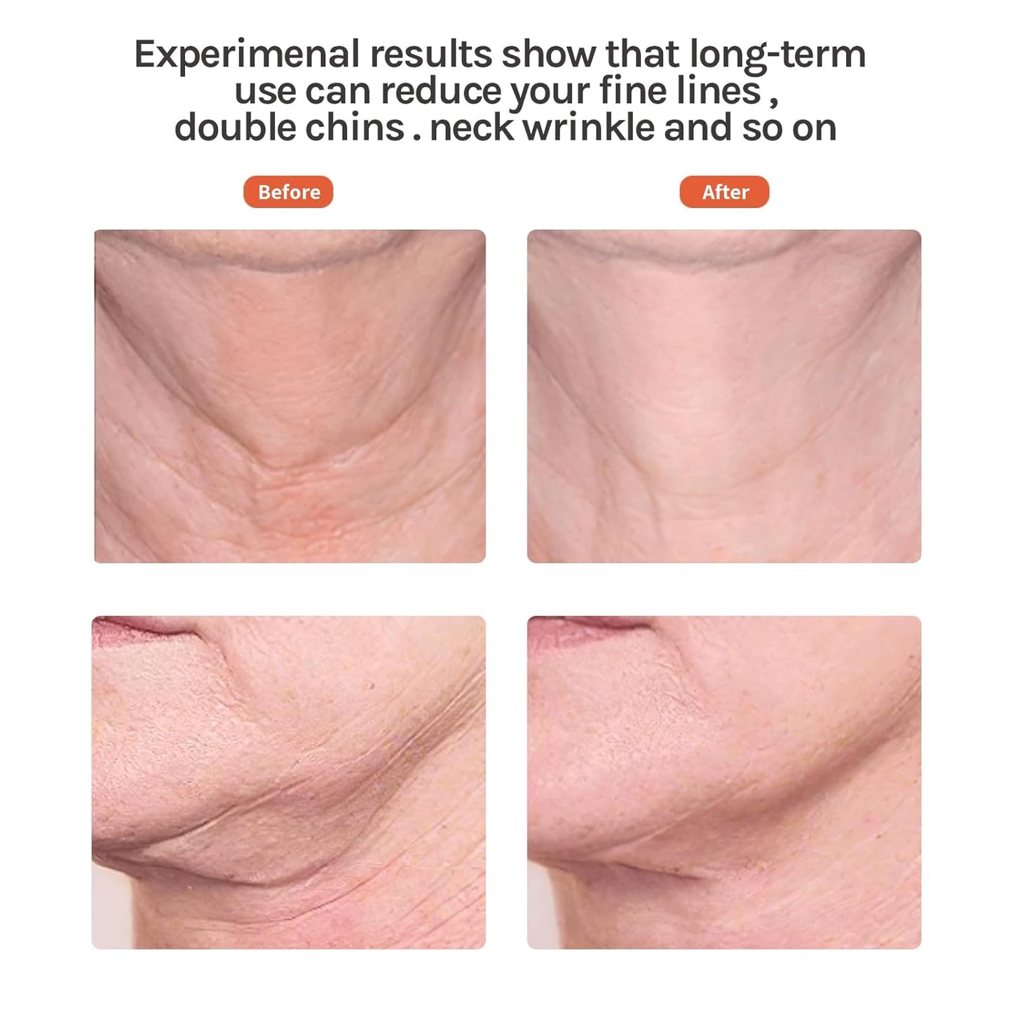 Red Light Facial Massager, Skin Care Tools for Face & Neck Beauty Device, 3 in 1 Face Massager Tool with LED, Thermal, Vibration, Tightenings, Rejuvenation for Women