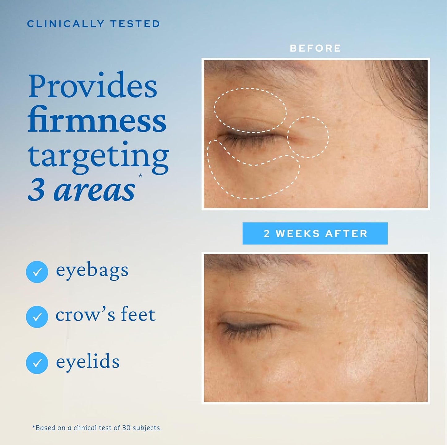 belif Peptide Eye Bomb, Anti-Aging Eye Cream for Wrinkles, Fine Lines, Crowโs Feet & Eye Bags, 48hr Hydration with Ceramide, Squalane, Caffeine, Dermatologist-Tested Korean Skincare, 0.84 fl.oz