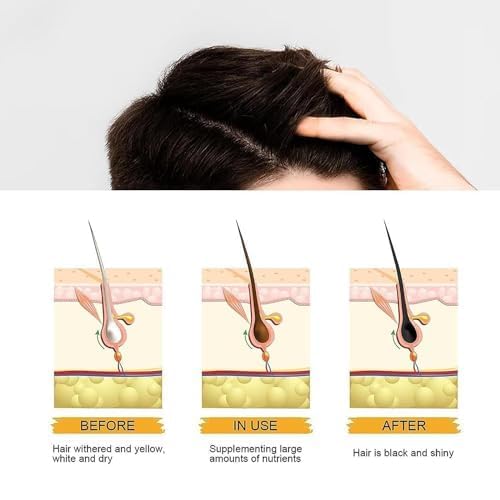 2PCS Shampoo Bar for Gray Hair,Purple Rain Shampoo Bar for Grey Hair,Shampoo Bars For Thinning Hair For Men & Women - Glowelle