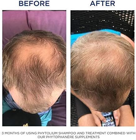 PHYTO Phytophanère 100% Natural Hair Loss Thinning Dietary Supplement, 4-Month Supply,Capsule, 120 Count (Pack of 2) - Glowelle