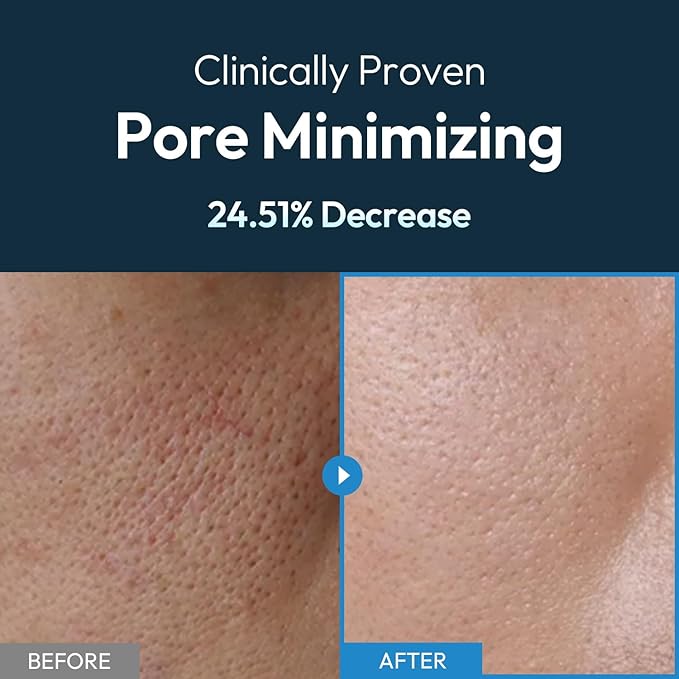 Men's Face Gel Moisturizer With Hyaluronic Acid for 24-Hour Hydration, Pore Minimizing and Non-Greasy Oil Control for All Skin Types - 3.71 fl oz