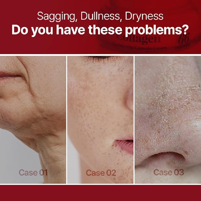 Collagen Face Cream Moisturizer, 66% Collagen Content, Hydrating & Firming, PDRN + Vitamin Capsule Cream, Korean Skincare, 50ml