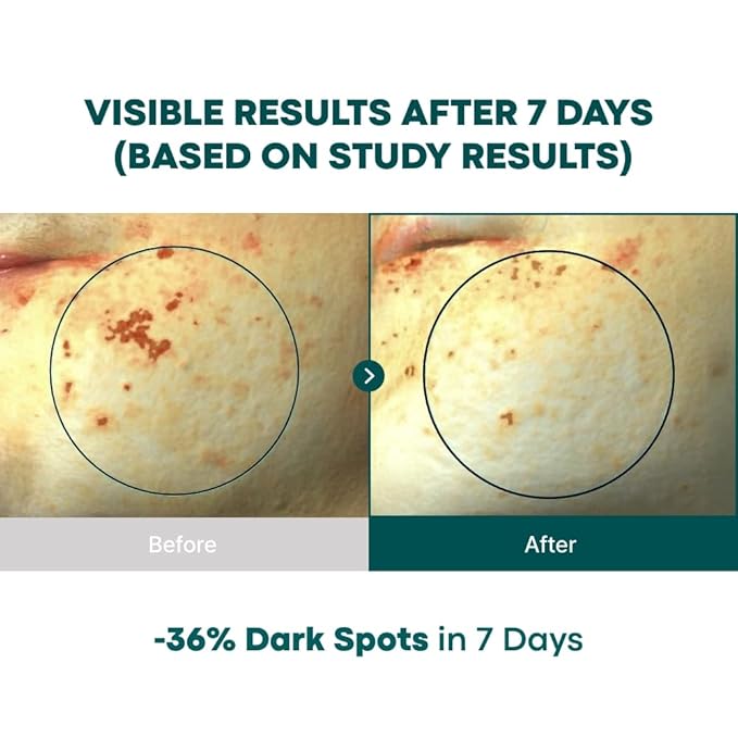 Vita C Capsule Double Shot Ampoule Kit + Vita C Conceal Eye Cream Bundle