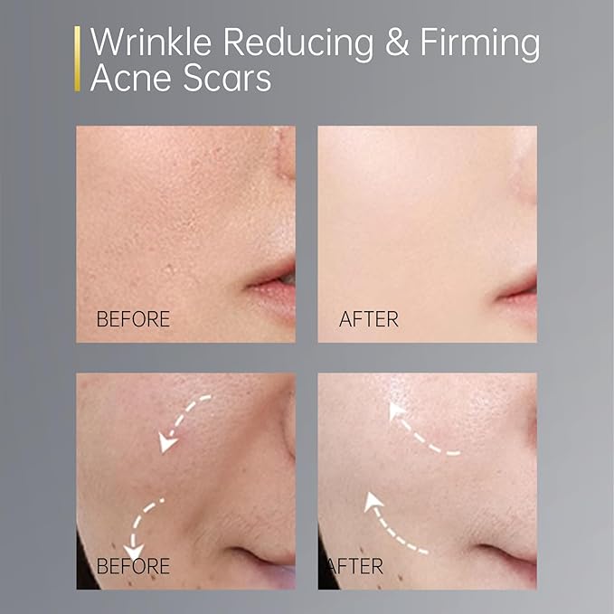 7 Day Type I & III Collagen Face Serums,Anti-Aging Wrinkle,Daily Line Smoothing Skin Care Treatment for Fine Lines, Post-Acne Scars | 3% Squalane + jojoba oil, 7 Individual Capsules