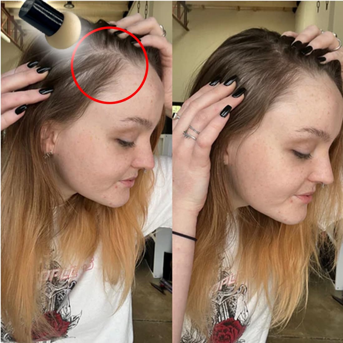 KERATIN RESEARCH Hairline Filler Unisex Mineral Powder Root Touch-Up Hair loss Concealer Scalp & Beard Bald Patch Coverage Fibers for Thinning Hair Waterproof Organic Natural look (WARM MED BROWN, XL)