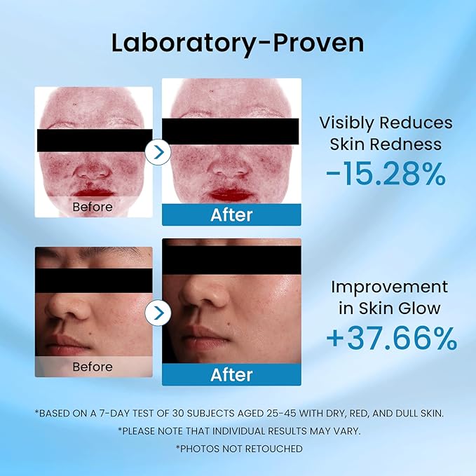 5X Ceramide Ultra Moisturizer Face Cream，with Ceramide Hyaluronic Acid Centella Collagen Hydration Relief Redness Reducing Ultra Repair Cream for Dry Skin Type