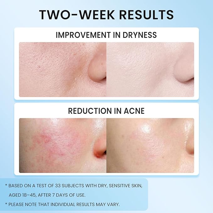 5X Ceramide Barrier Moisturizer Face Cream, With Ceramide Hyaluronic Acid Centella Collagen Hydration Relief Redness Reducing Ultra Repair Cream for All Skin Type Sensitive Skin 1PC