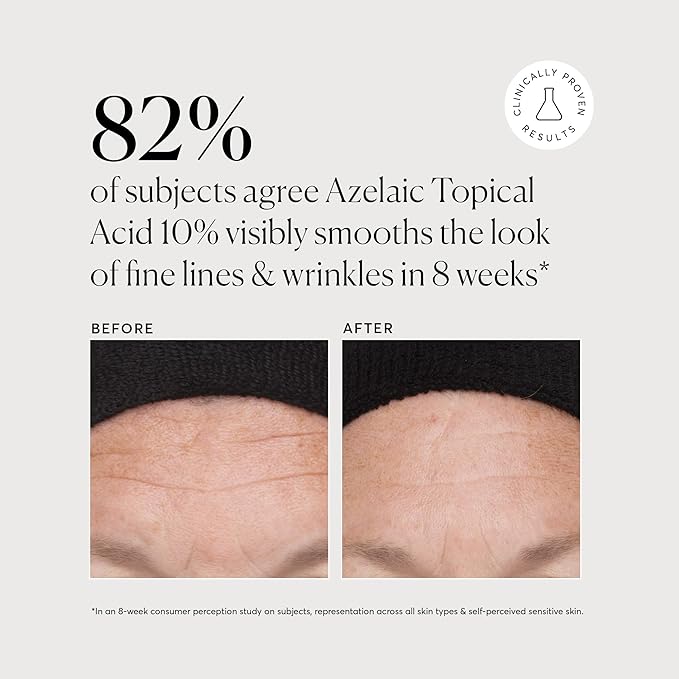 Naturium Azelaic Topical Acid 10% Jumbo, Face & Skin Care Beauty Treatment with Niacinamide & Vitamin C, 2 oz