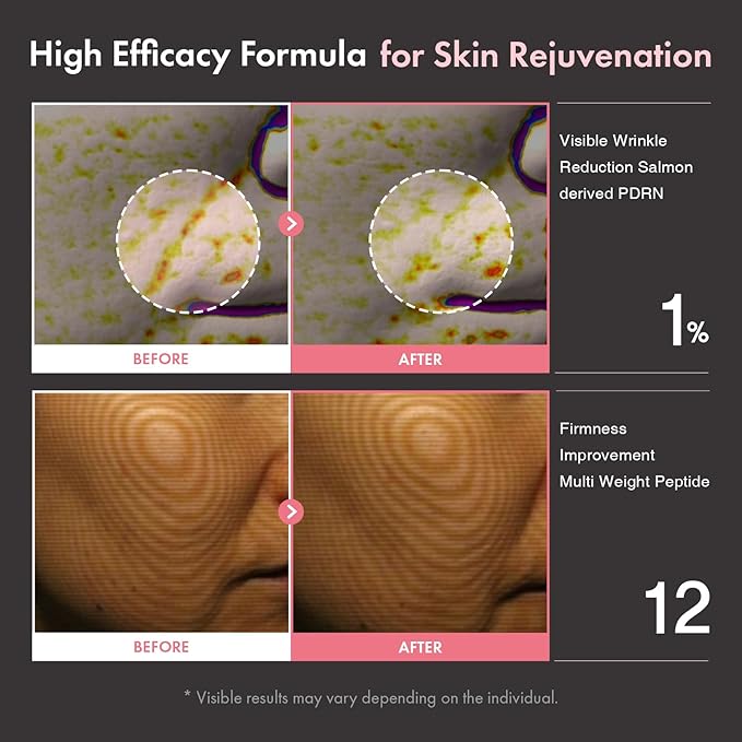 TOSOWOONG PDRN Peptide 12 Capsule Cream, Salmon DNA 10,000ppm, 12 Peptides Moisturizer for Anti Aging, Wrinkle & Fine Lines, 8 Hyaluronic Acids Hydration, Korean Skincare, 50ml / 1.69 fl. oz.