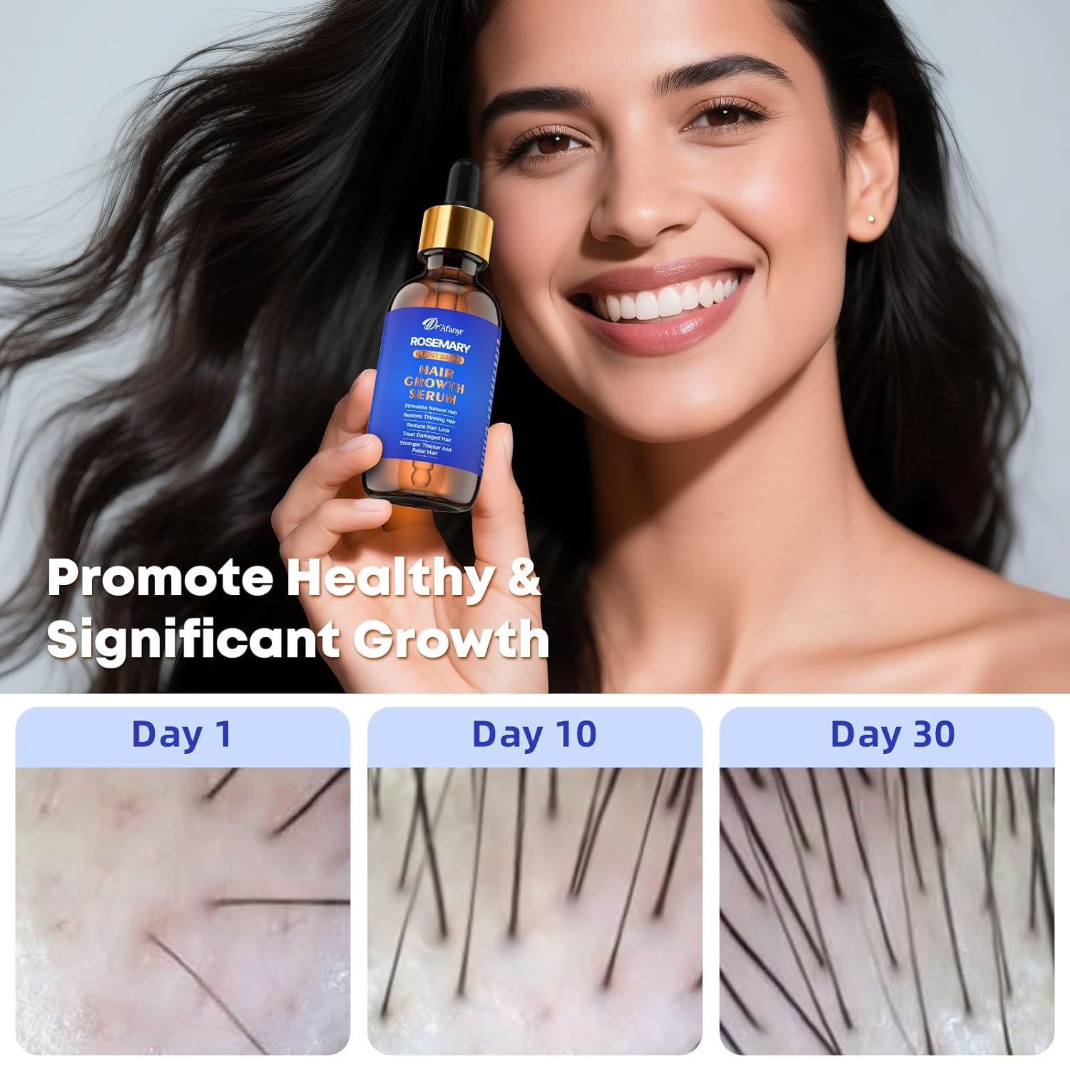 Hair Growth Serum with Rosemary Oil & Saw Palmetto - 100% Natural Plant-Based Formula to Stimulate Follicles, Revive Roots for Visibly Thicker Fuller Hair, Reduce Shedding and Loss For Men & Women - Glowelle