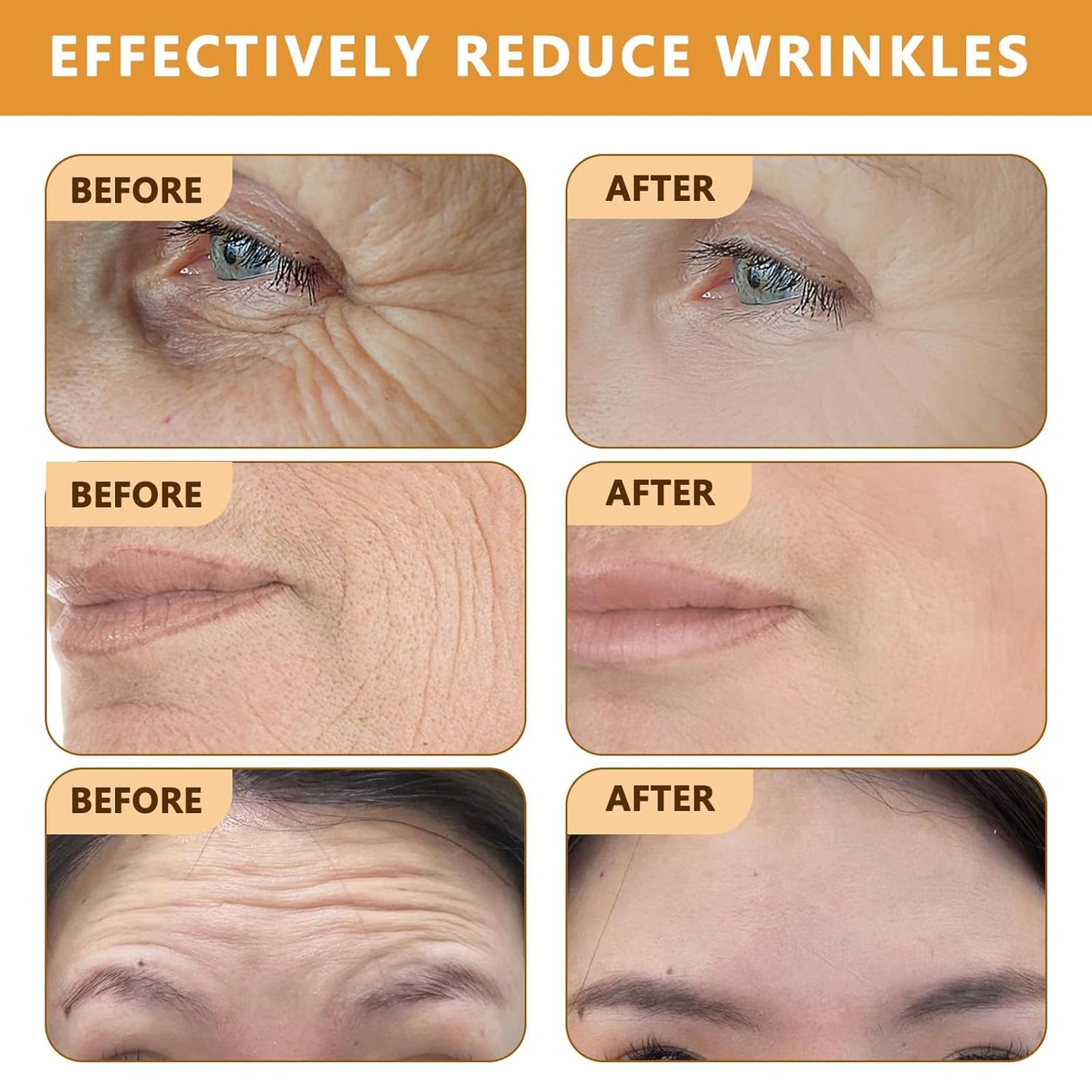 Botoxin Bee Venom Wrinkle Removal Cream, Anti-Aging, Restore and Enhance Skin Elasticity, Natural and Non-Irritating, Suitable for Sensitive, Dry, Oily Skin 0.71 Ounce (Pack of 3)