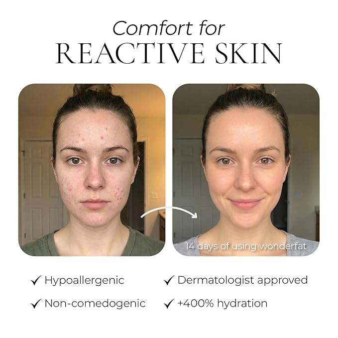 Grass-Fed Whipped Tallow Balm, Face and Body Moisturizer with Manuka Honey, Fragrance Free Tallow Moisturizer for Sensitive Skin, Lightweight Tallow Cream, 3 oz