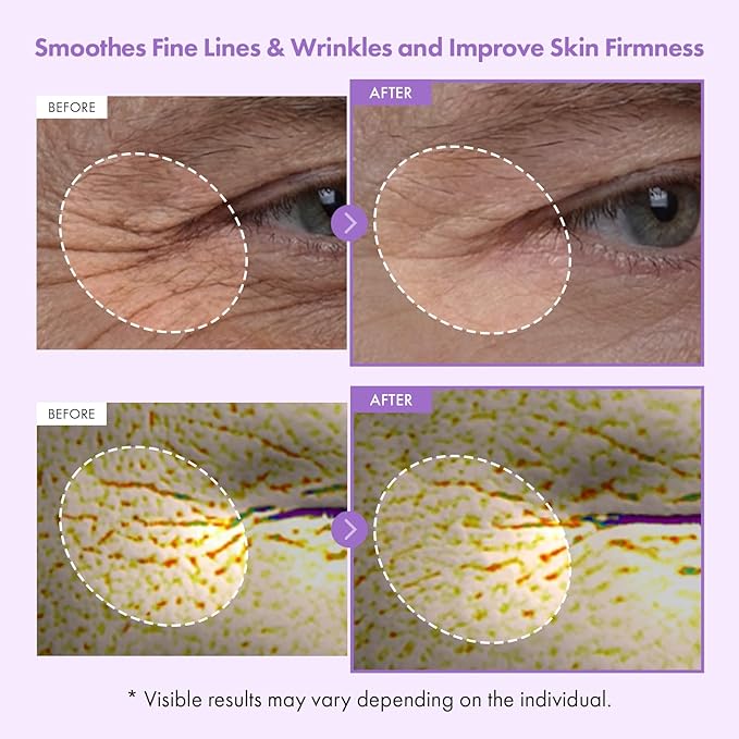 TOSOWOONG Gentle Anti-Aging Starter Set - Soothing Madagascar Centella Face Wash + High Purity Bakuchiol Capsule Cream - Retinol Alternative Routine for Sensitive Skin Firming