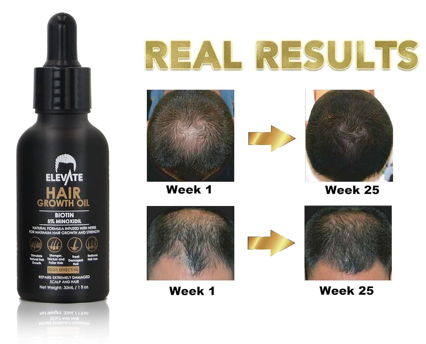 Elevate Hair Regrowth Treatment 5% Minoxidil Solution - Biotin Serum Hair Growth Oil for Men & Women - Thicker Fuller Stronger Hair - Stops Hair Loss & Thinning - Natural Hair Thickening Treatment 1oz - Glowelle