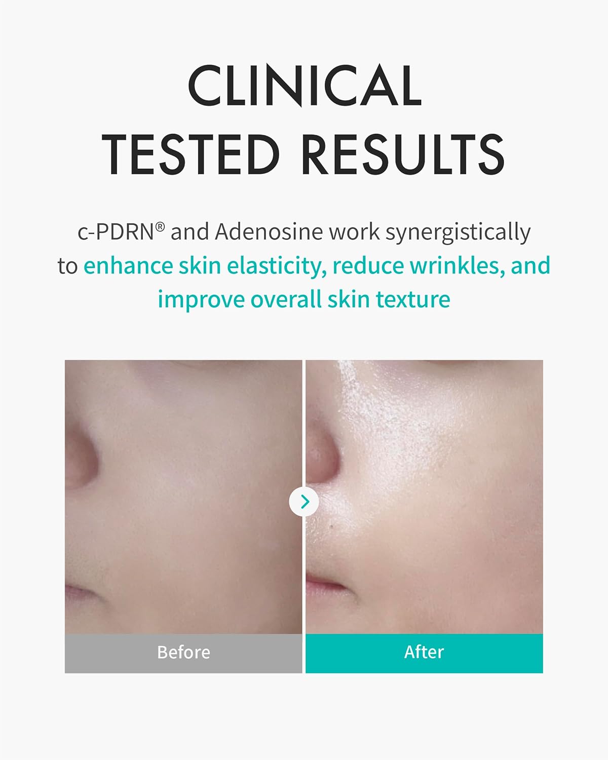 REJURAN® Turnover Mask, c-PDRN® (5ea) – Original Salmon DNA for Firming, Hydration, Repairing & Revitalizing. Achieve Youthful, Radiant Skin. Korean Skincare. Ultra Microfiber Sheet Mask