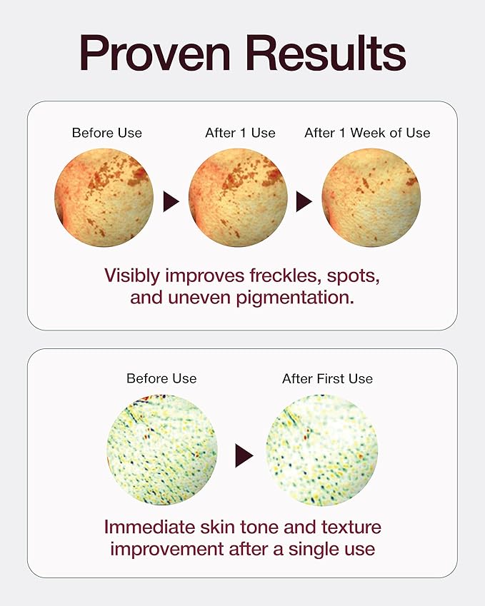 CENTELLIAN 24 Madeca Mela Capture Brightening Bundle – Ampoule Capsule Cream (55ml) + Ampoule Max Serum (0.5 fl oz) + Ampoule Pads (60 pcs) – Korean Skincare Set for Tone Correction, Hydration