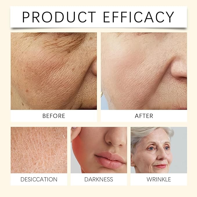 Vitamin C + Niacinamide Moisturizer, Deep Vita C Capsule Cream with 5% Niacinamide & Sea Buckthorn Extract, Daily Face Cream for Dullness, Improves Skin Radiance and Texture, 50g