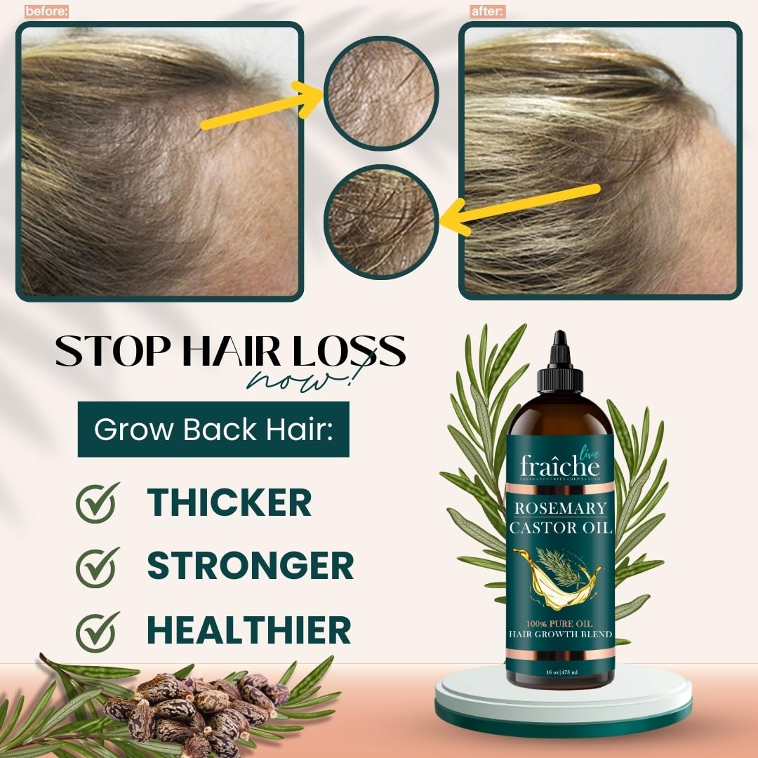 Live Fraiche Rosemary Castor Oil for Hair Growth 16oz - Rosemary Oil for Hair Growth and Thickening Pure Blend to Reduce Loss and Promote a Healthy Scalp - Glowelle
