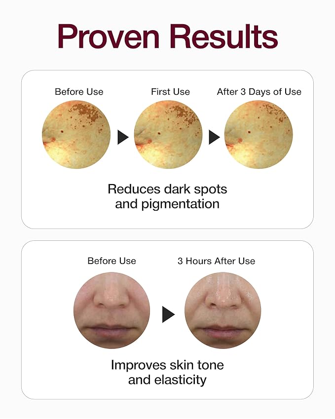 CENTELLIAN 24 Madeca Mela Capture Brightening Bundle – Ampoule Capsule Cream (55ml) + Ampoule Max Serum (0.5 fl oz) + Ampoule Pads (60 pcs) – Korean Skincare Set for Tone Correction, Hydration