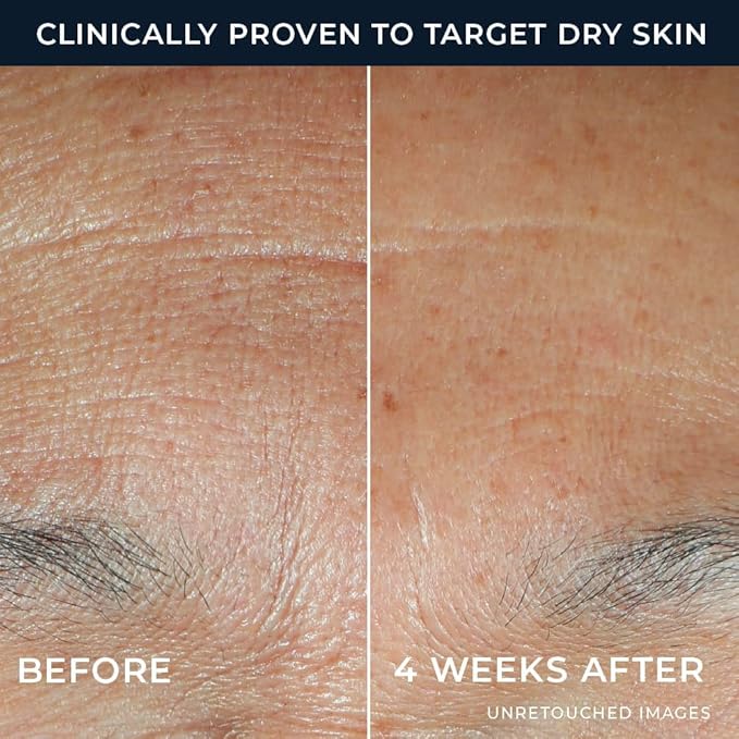 RoC Hydration+ Hyaluronic Acid Serum for Face, Hydrating, Plumping, Fragrance Free, Lightweight Formula with Collagen Proteins (1 Ounce) with Retinol Eye Cream Packette