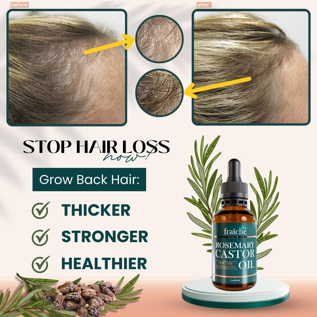 Live Fraiche Rosemary Oil for Hair Growth (2oz) with Cold Pressed Castor Oil Natural Hair Growth Oil - Rosemary and Castor Oil for Hair Growth -Strengthening Hair Oil for Damaged Hair and Hair Loss - Glowelle