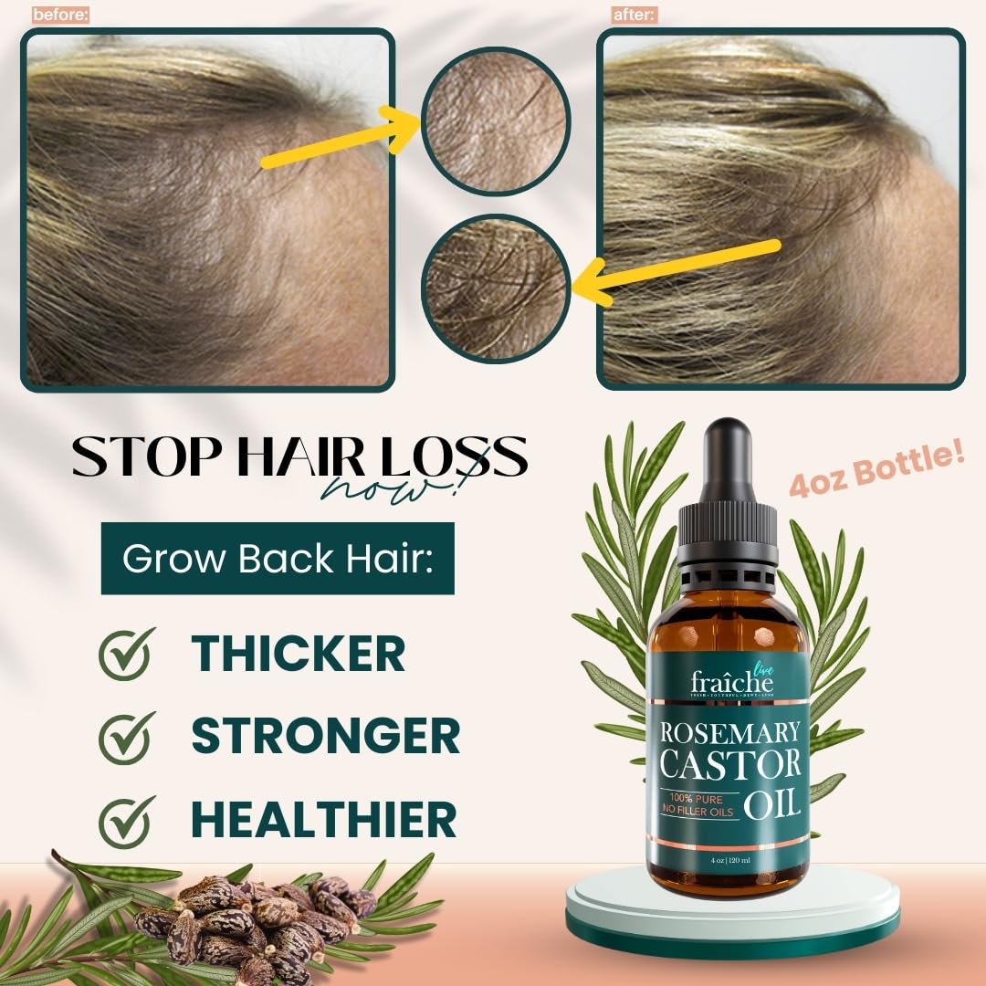 Live Fraiche Rosemary Castor Oil for Hair Growth 4 Ounce - Cold Pressed Castor Oil and Rosemary Oil for Damaged Hair to Reduce Hair Loss - Glowelle