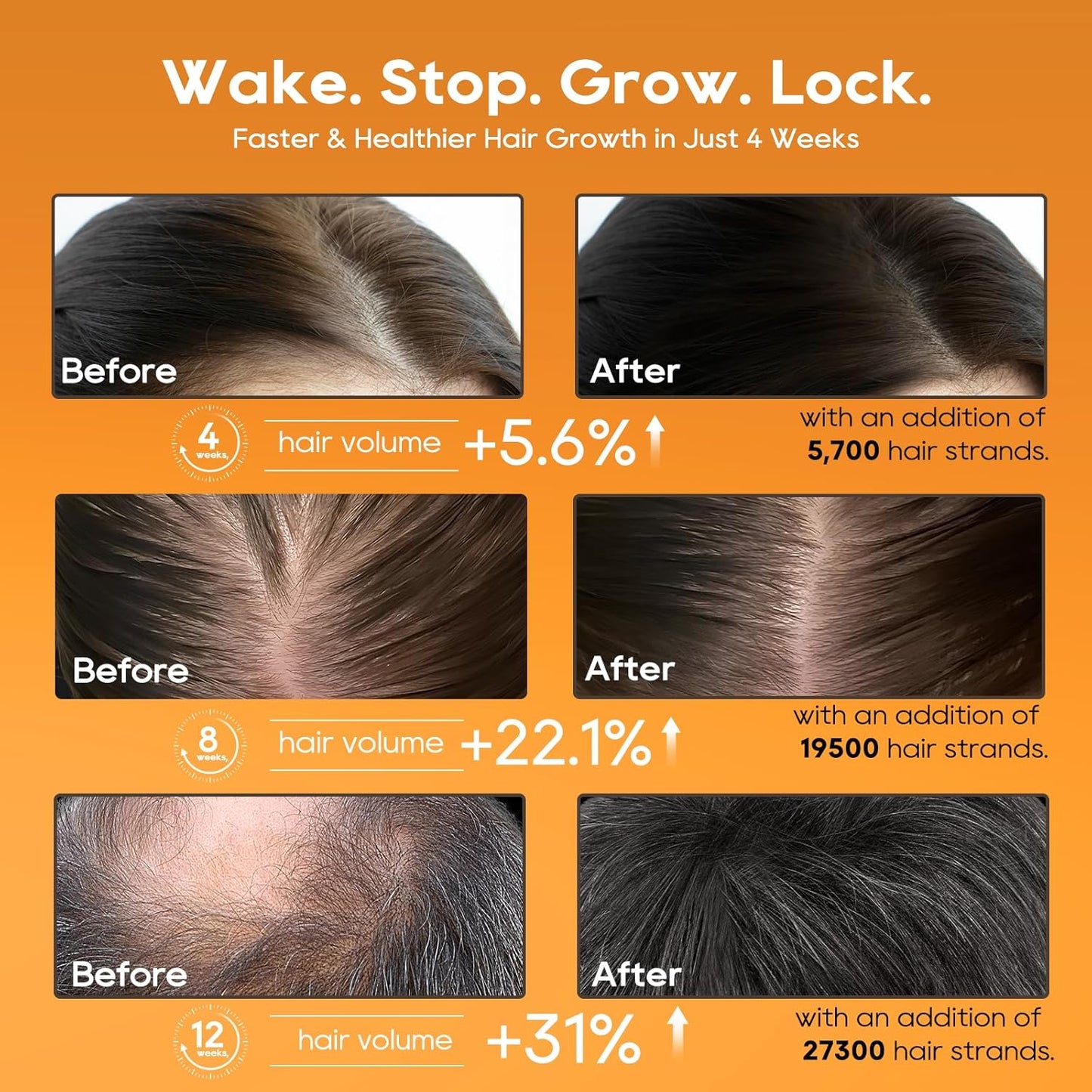 Women‘s Hair Growth Serum Oil, 100% Veganic Natural Herbal Extracts, Root Revive Visibly Thickening Fuller Hair, Follicle Stimulator Scalp Serum for Hair Loss/Shedding,Thin, Dry & Damaged Treatment - Glowelle