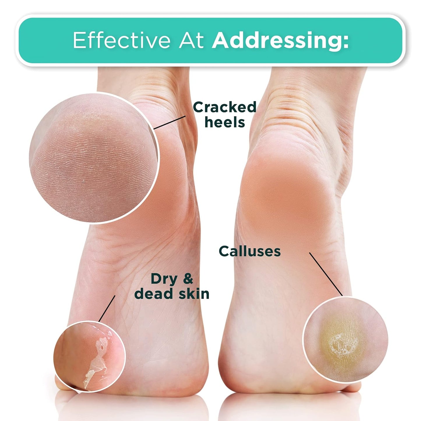 DERMORA Foot Peel Mask - 2 Pack of Regular Size Skin Exfoliating Foot Masks for Dry, Cracked Feet, Callus, Dead Skin Remover for Baby Soft Feet, Original Scent