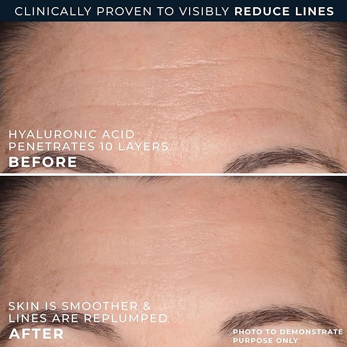 RoC Hydration+ Replumping Serum Stick, Fragrance-Free, Hydrating And Cooling Hyaluronic & Peptide Formula To Boost Elasticity And Visibly Smooth Aging Skin, With Line Smooth Eye Cream Packette, 0.7oz