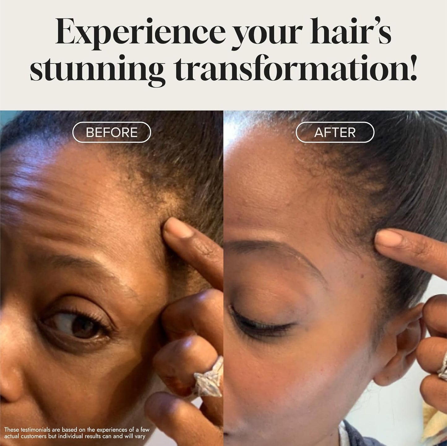 Biotin Hair Growth Serum Advanced Topical Formula To Help Grow Healthy, Strong Hair Suitable for Men and Women of All Hair Types Hair Loss Support By Pureauty Naturals 2 Fl Oz (Pack of 1) - Glowelle