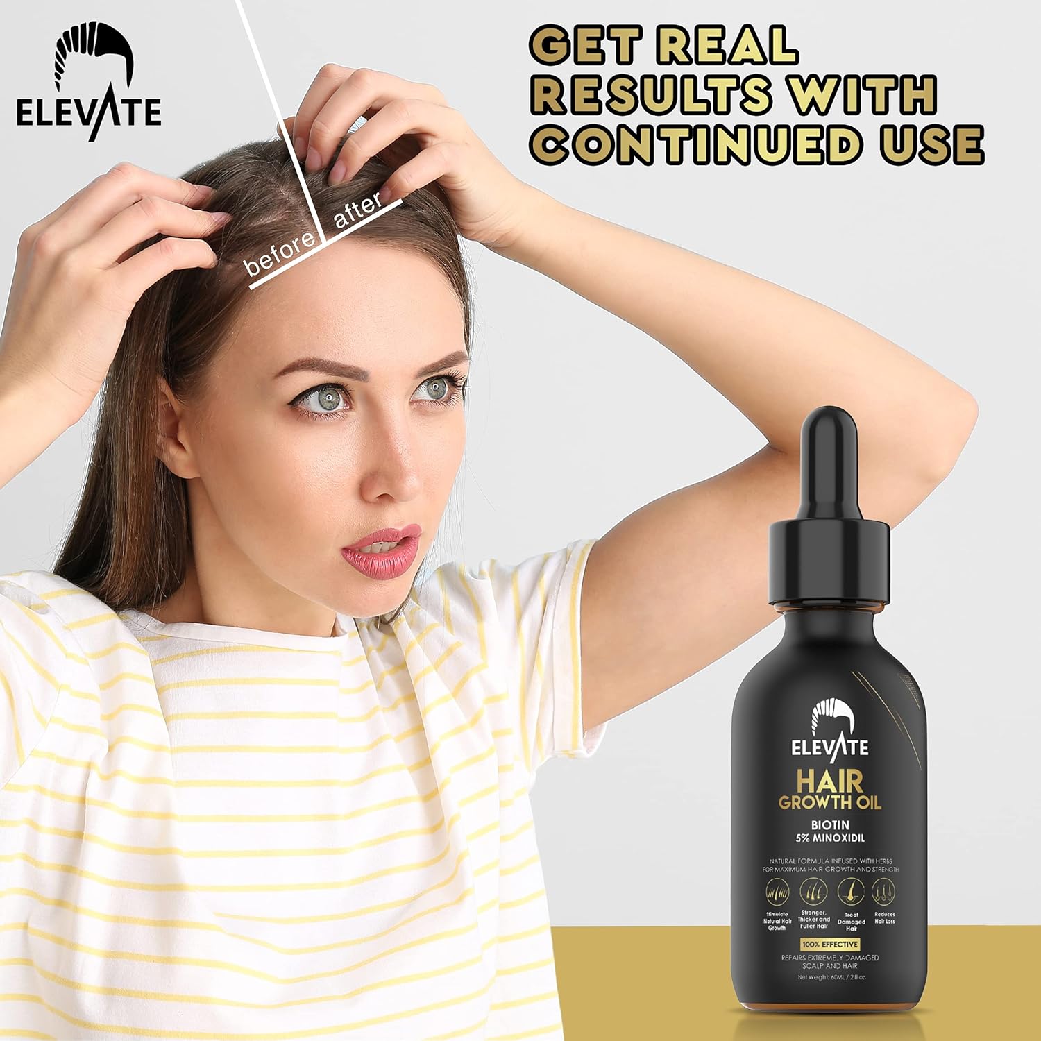 Elevate Hair Regrowth Treatment 5% Minoxidil Solution – Biotin Serum Hair Growth Oil for Men & Women - Thicker Fuller Stronger Hair - Stops Hair Loss & Thinning - Natural Hair Thickening Treatment 2oz - Glowelle