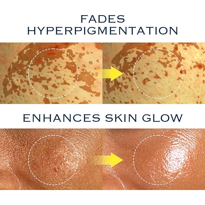 Radiance Balance Duo Set | Glow Reset Toner + NIACINDY Capsule Cream | Korean Clinical Skincare with NAD Biome, Niacinamide & Thioctic Acid | Tone-Refining, Repairing & Hydrating Routine